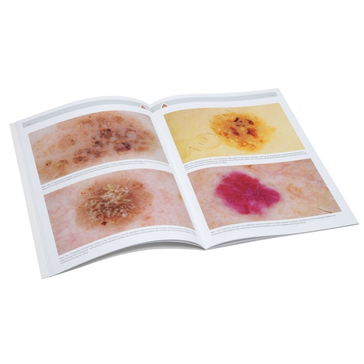 Dermatoscopio HEINE DELTA 20T Set recargable