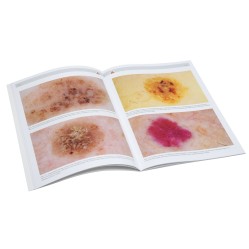 HEINE compendio de dermatoscopia