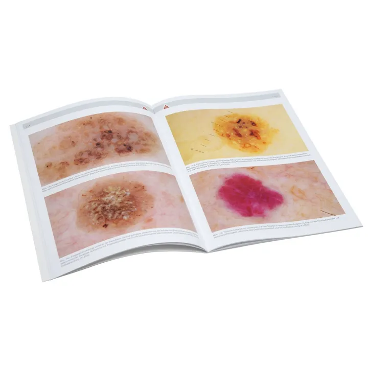 HEINE compendio de dermatoscopia