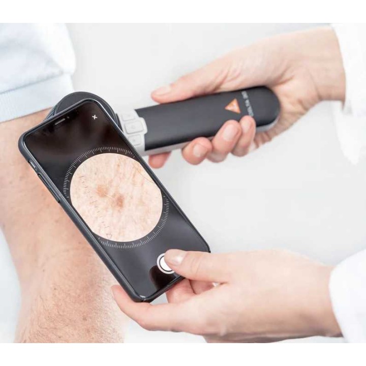 HEINE DELTA 30 Dermatoscope with HEINE DERM app