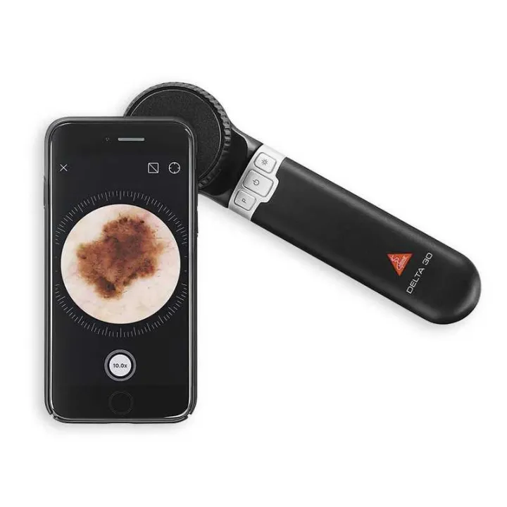 Dermatoscope HEINE DELTA 30