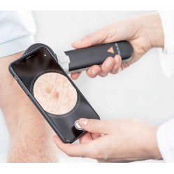 Dermatoscope HEINE DELTA 30 avec application HEINE DERM