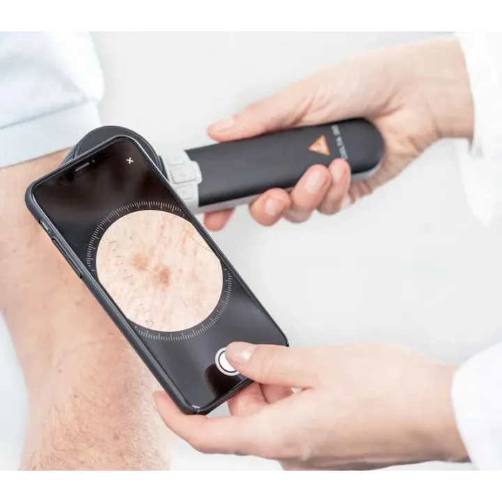 HEINE DELTA 30 Dermatoscope with HEINE DERM app