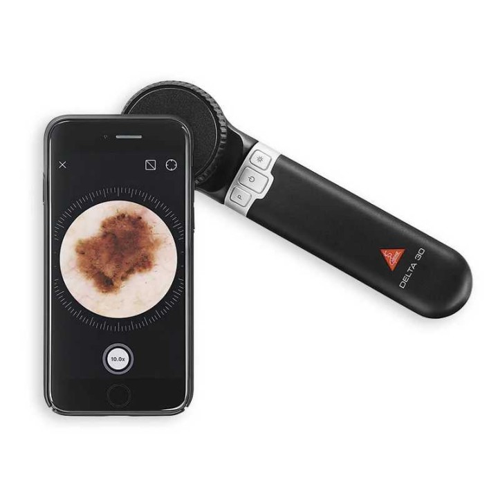 Dermatoscope HEINE DELTA 30
