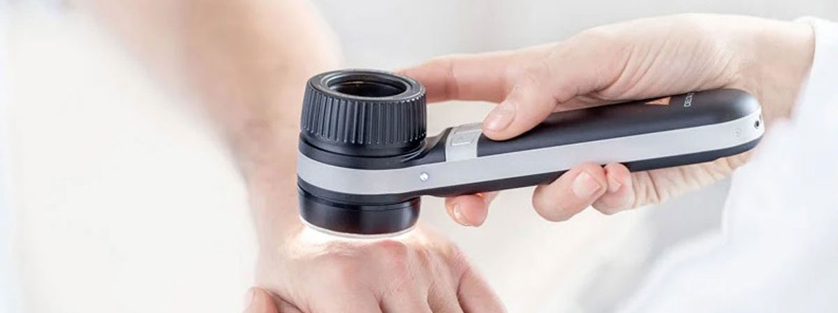 Dermatoscopes